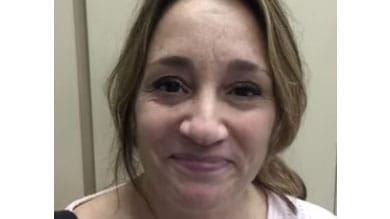 Our patient speaks about her Invisalign journey.