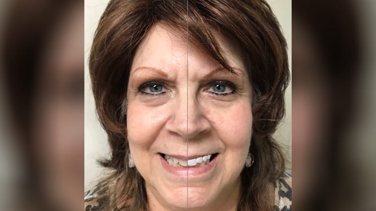 Frontal Facial Full Smile - Goochland Dentistry, VA