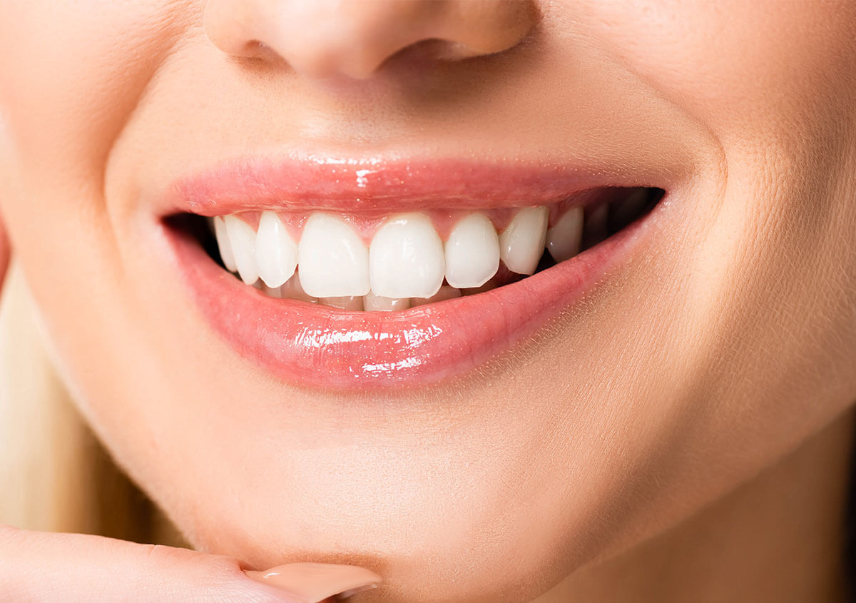 How Can I Make My Teeth Whiten Less Painful in Manakin-sabot Area