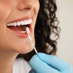 The Benefits of Dental Crowns for Restoring Damaged Teeth