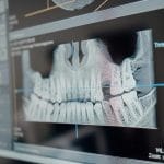 Digital Dentistry in Action