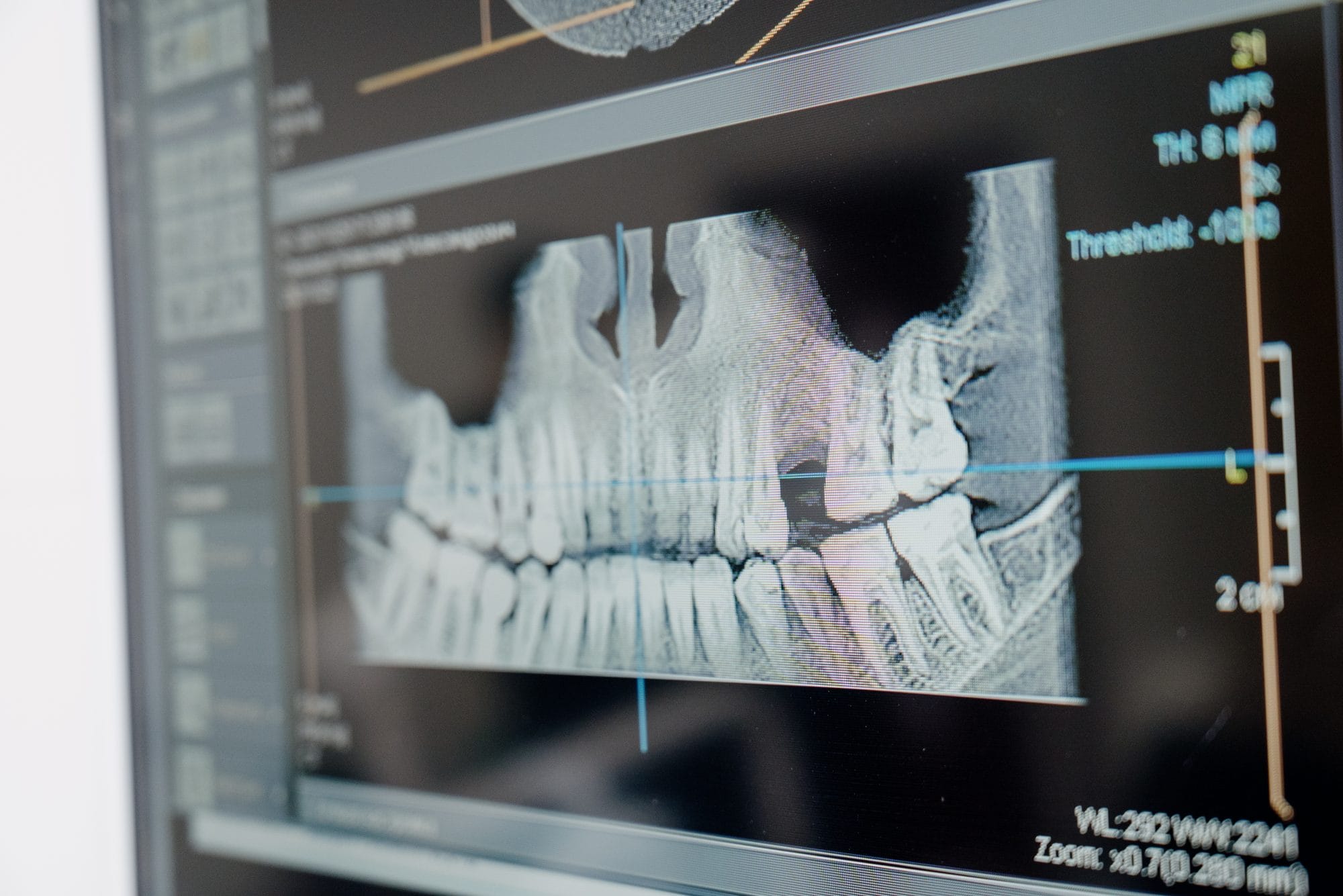 Digital Dentistry in Action