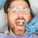 Natural-Looking Composite Fillings: What to Know