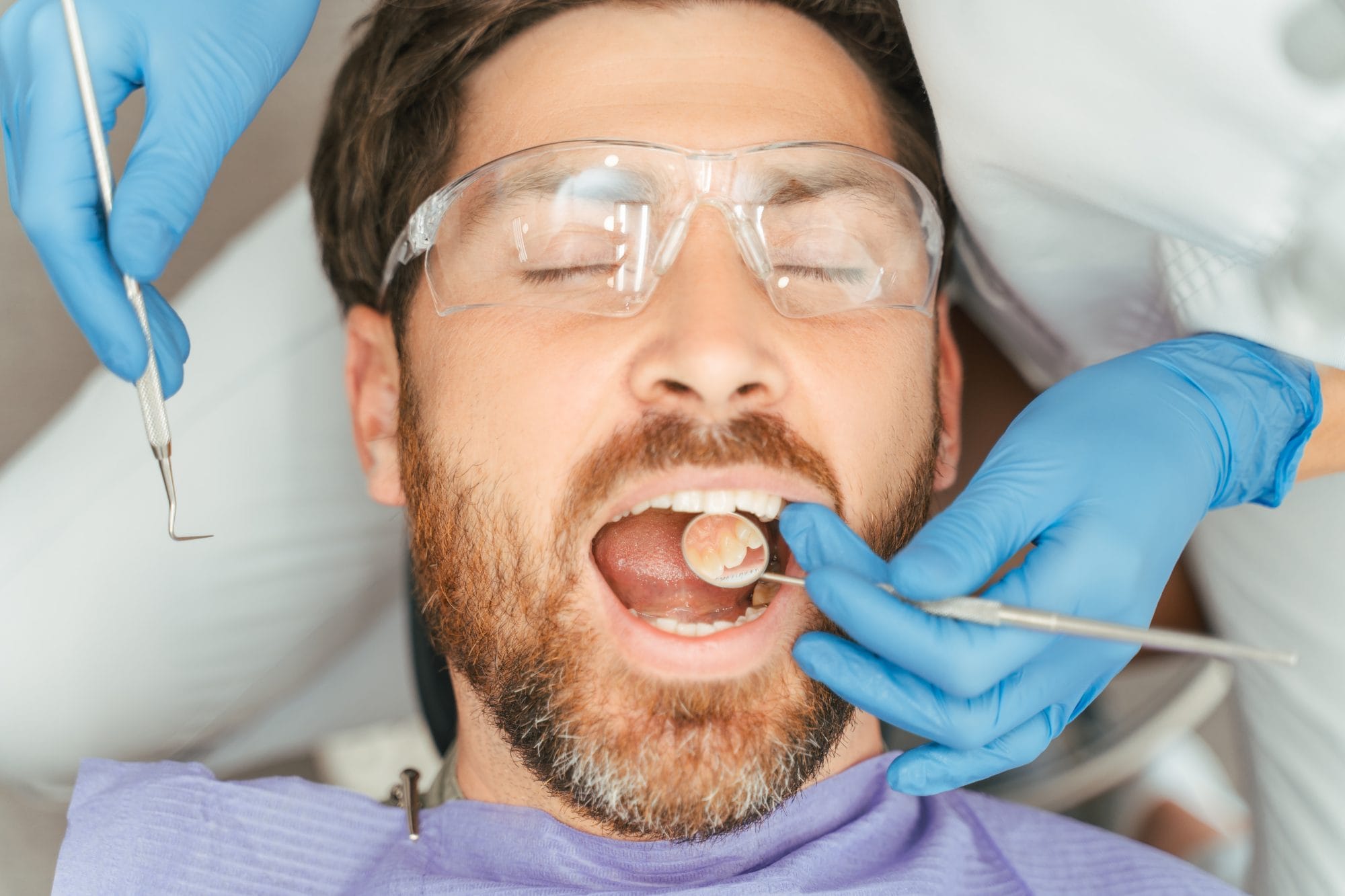 Natural-Looking Composite Fillings: What to Know