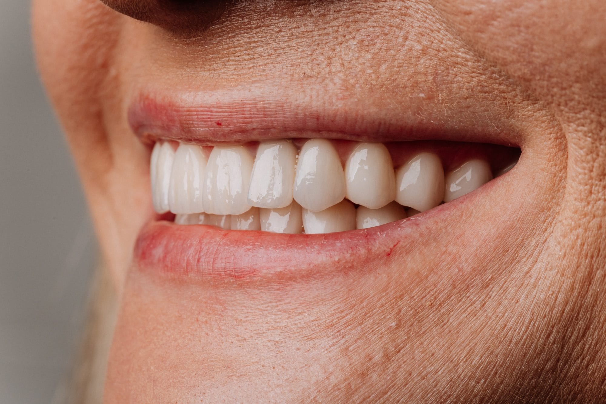 New Year Smile Guide: Teeth Whitening and Stain Prevention