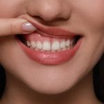 Why Winter Is the Best Time to Treat Gum Disease Before Spring Smiles
